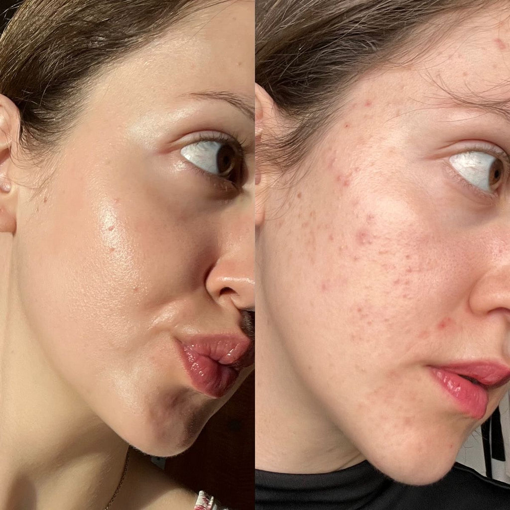 Panoxyl 4% cleanser
